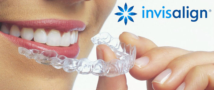 Invisalign Provider in Kew, Richmond. Clear braces, advanced teeth  straightening